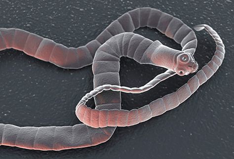 human tapeworm Tapeworms In Humans, Tape Worm In Humans, Giant Microbes, Intestinal Parasites, Diy Pest Control, Nutrition Guidelines, Bad Diet, Medical Facts, Cat Fleas