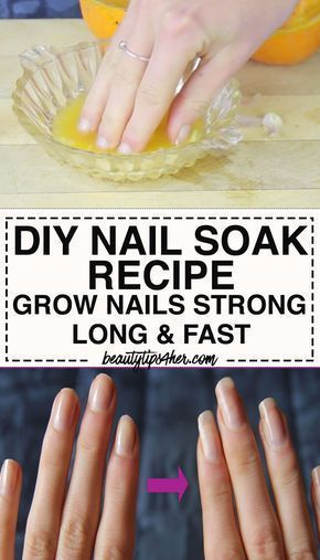 Do It Yourself Nails, Diy Natural Detergent, Fast Nail, Stronger Nails, Nail Soak, Broken Nails, Health Signs, Nail Care Tips, Homemade Lotion