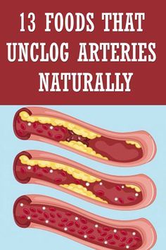 Clear Arteries, Unclog Arteries, Avocado Salmon, Clogged Arteries, Heart Healthy Diet, Makanan Diet, Natural Juices, Cardiovascular Health, Good Health Tips