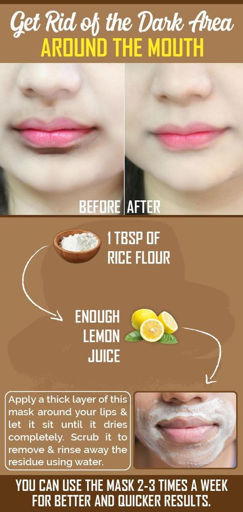 Here Are Some Simple Home Remedies To Remove Darkness Around Lips Naturally Dark Skin Around Mouth, Clear Healthy Skin, Natural Face Skin Care, Natural Skin Care Remedies, Lip Care Routine, Skin Care Face Mask, Good Skin Tips, Skin Dryness, Perfect Skin Care Routine