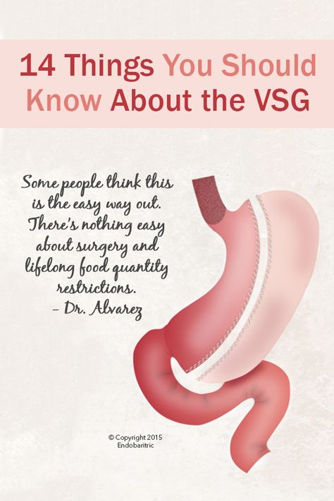 Sleeve Surgery Before And After, Sleeve Surgery Diet, Vsg Diet, Bariatric Recipes Sleeve Liquid Diet, Gastric Bypass Sleeve, Bariatric Recipes Sleeve, Vsg Surgery, Vertical Sleeve Gastrectomy, Bariatric Sleeve