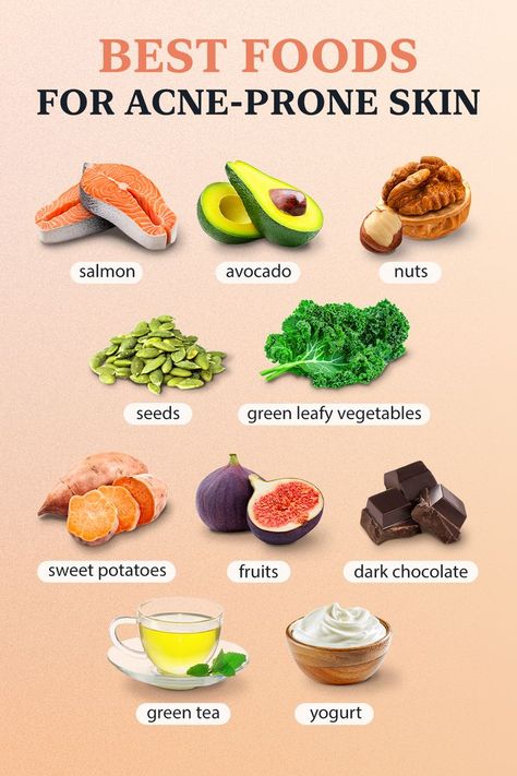 The Best Foods for Acne-Prone Skin Essen, Foods Good For Acne, Acne Free Diet, Foods For Skin Health, Food For Acne, Acne Causing Foods, Best Foods For Skin, Glowing Skin Diet, Foods For Clear Skin