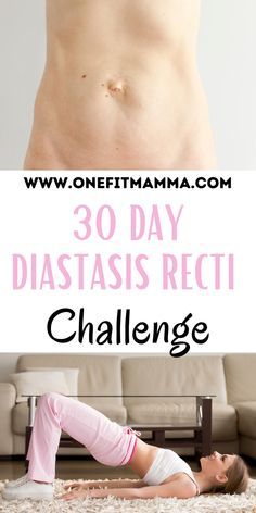 Workouts For Csection Moms, Diastasis Recti 30 Day Challenge, Ab Workout Postpartum, Exercise For Recti Diastasis, Ab Separation Diastasis Recti Exercise, Postpartum Ab Workout Diastasis Recti, Abs For Diastasis Recti, Diastis Recti Exercises Before And After, Diastasis Recti Exercise Plan