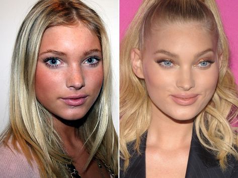 Elsa Hosk as a teenager (left) and in 2017 (right). Elsa Hosk Street Style, Elsa Hosk Style, Brassy Hair, Celebrity Plastic Surgery, Pink Eye Makeup, Hair Scarf Styles, Celebrities Before And After, Icy Blonde, Perfect Lips