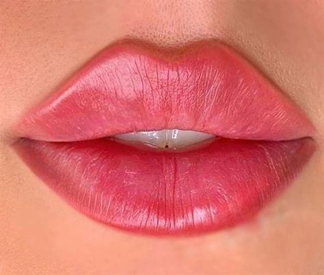 WHY Russian Lips are THE HOTTEST NEW TREND Russian Lip Filler, Russian Lips, Face Fillers, Lips Inspiration, Botox Lips, Facial Fillers, Lip Augmentation, Facial Aesthetics, Lip Filler