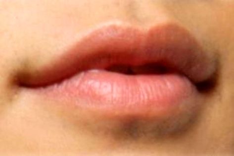 LL Types Of Lips, Balzam Na Pery, Heart Shaped Lips, Lip Types, Fall Lips, Head Anatomy, Lips Photo, 얼굴 드로잉, Face Drawing Reference