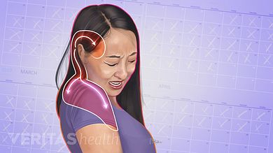 Tmj Headache, Neck Headache, Severe Neck Pain, Health Websites, Forward Head Posture Exercises, Headache Causes, Neck And Shoulder Muscles, Chronic Back Pain, Neck Problems