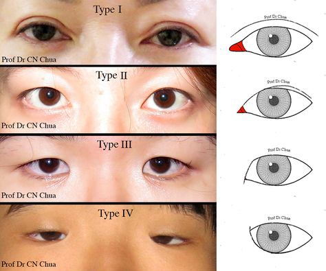 Epicanthal Fold, Epicanthic Fold, Wide Set Eyes, Eye Anatomy, Deep Set Eyes, Face Study, Face Drawing Reference, Anatomy Study, Face Reference