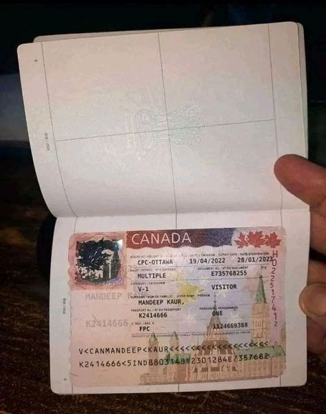 Canada Resident Card, Canadian Visa Picture, Canada Visa Photo, Driving License Picture, Visa Picture, Germany Passport, Kids Surgery, Canada Passport, Working Pictures