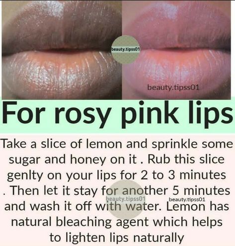 Pink Lips How To Get Naturally, For Pink Lips, Remedies For Dark Lips, Dehydrated Lips, How To Make Pink, Tips For Glowing Skin, Lips Care, Clear Healthy Skin, Natural Skin Care Remedies