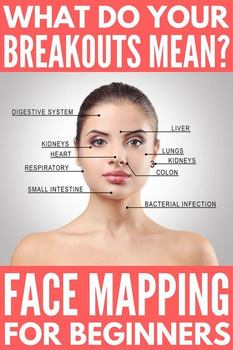 Your complete breakout map guide! If you haven’t heard of face mapping, take note! The location of your acne and breakouts isn’t random, it can actually tell you a lot about your health. If you struggle with bad skin and have exhausted all of the products and natural remedies that promise to get rid of acne without success, we’re sharing our best tips to help you understand what your breakouts mean and what you can do to control and (hopefully) eliminate them completely. Breakout Map, Doterra Acne, Gesicht Mapping, Bad Skin, Face Mapping Acne, Face Mapping, Get Rid Of Acne, Rid Of Acne, Natural Acne