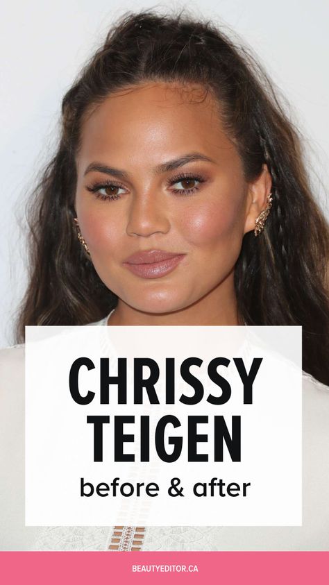 Christy Teigen Hair, Celebrities Before And After Surgery, Cryoslimming Before And After, Celebrity Before And After, Crissy Teigen Hair Hairstyles, Chrissy Metz Before And After, Tirzepatide Before And After, Semiglude Before And After, Upper Blephoraplasty Before And After