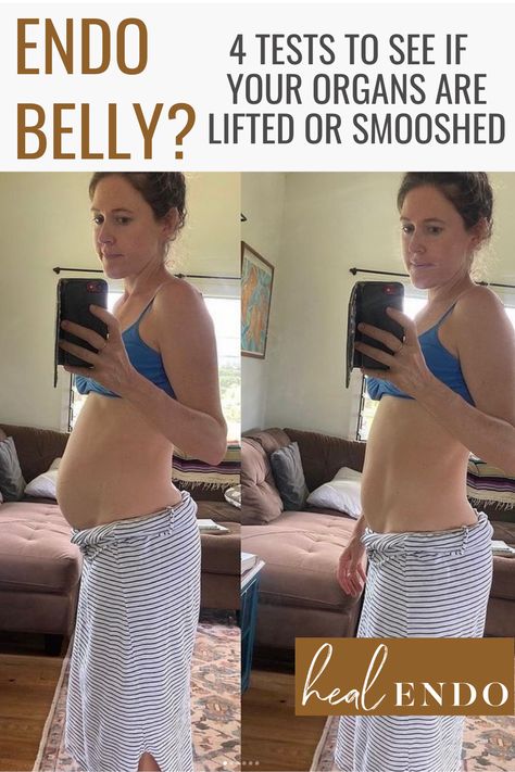 If you have a big endo belly lower belly pooch, check for core dysfunction! It may be a visual of your organs being pushed down thanks to poor core function. Learn how to lift them back up, rather than sucking in! #endometriosis #endobelly #endometriosisbloat #endodiet What Causes Lower Belly Pooch, Endo Belly Diet, Why Do I Have A Lower Belly Pooch, Pooch Belly Workout, Core Dysfunction Exercises, Gluten Belly Before And After, Endo Belly Pictures, Dressing With A Belly Pooch, Endo Belly Outfits