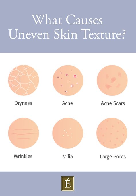 We’re all after #skin with a smooth surface, but the reality is that most of us experience uneven skin texture 😤 Learn more about what causes textured skin and how to improve it. ---- #skintexture #skincare #skincaretips How To Smooth Skin, How To Smooth Textured Skin, Uneven Texture Skin, Uneven Skin Texture Skincare, How To Improve Skin Texture, Textured Skin Routine, Skincare For Textured Skin, How To Get Smooth Skin, Dry Textured Skin