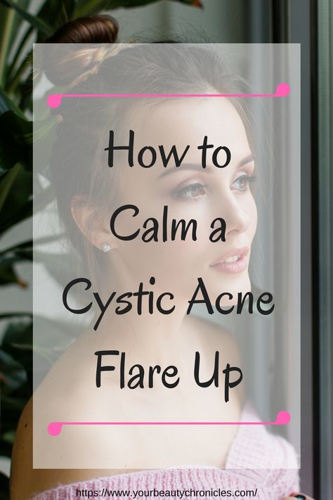 Cystic Acne On Chin, Nodule Acne, Treating Cystic Acne, Cystic Acne Remedies, Cream Tattoo, Blind Pimple, Natural Acne, Natural Acne Remedies, Types Of Acne