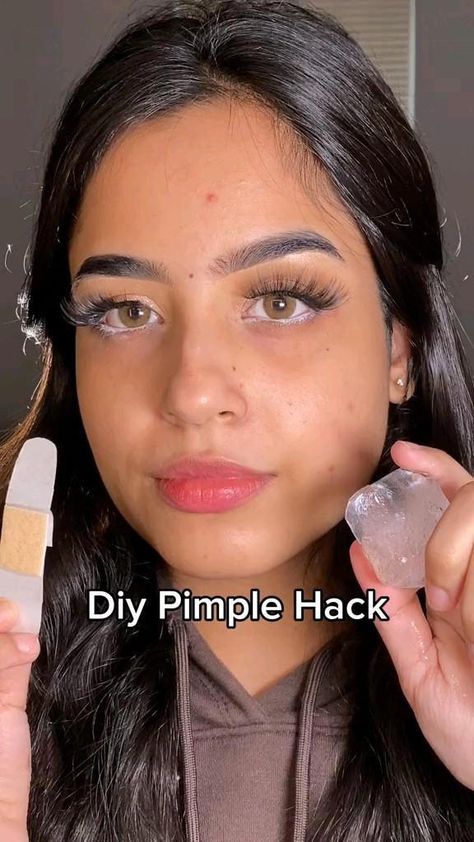 Pimple Hacks, Cinnamon Face Mask, Huge Pimple, Ear Pimple, Overnight Remedies, Face Mapping Acne, Diy Masks, Zits Popping, Pimples On Face