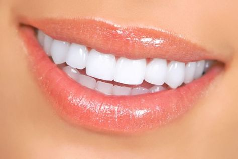Snap On Smile, Natural Teeth Whitening Diy, Pretty Teeth, Kedokteran Gigi, Veneers Teeth, Beautiful Teeth, Teeth Whitening Remedies, Teeth Whitening Diy, Laser Teeth Whitening