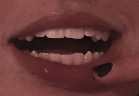 K9 Teeth Human Aesthetic, Chipped Teeth Aesthetic, Shifting Feature Claims, Teeth Aesthetic Grunge, Natural Sharp Teeth, Cute Teeth Aesthetic, Teeth Claims For Dr Sharp, Pretty Teeth With Fangs, Cute Birthmarks Shifting