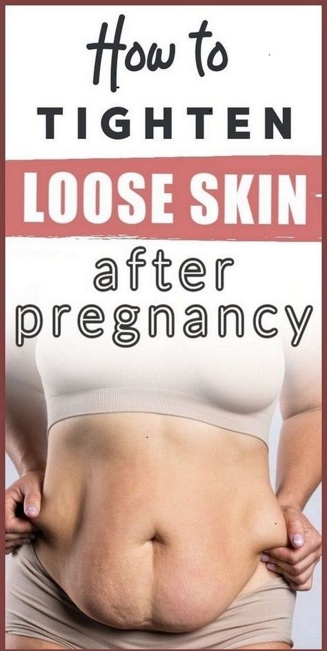 Belly After Baby, Post Pregnancy Belly, Post Pregnancy Body, Loose Belly, Post Pregnancy Workout, Tighten Loose Skin, Natural Beauty Remedies, Postpartum Belly, Baby Workout