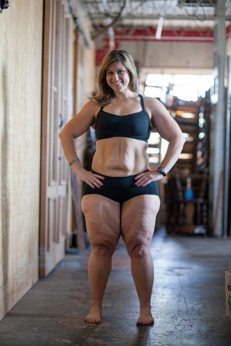 10+ reasons I love my ugly body - so inspirational, I look like this and will never 'look good naked', but I can still be strong and fit. Body Check, True Strength, Beautiful Story, Loose Skin, Strong Woman, Body Love, Body Inspiration, Loving Your Body, Let's Celebrate