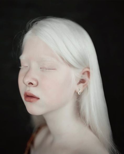 White Hair, Albino Human, Albino Girl, Human Poses, Whiter Skin, Creative Hairstyles, Pale Skin, Aesthetic Photo, Cartoon Styles