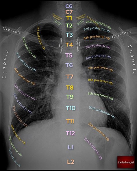 Radiology Technician Aesthetic, Radiology Student Aesthetic, Radiology Schools, Medical Assistant Student, Radiology Student, Radiology Technician, Medical School Life, Basic Anatomy And Physiology, Instagram Review