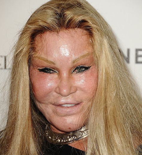 Plastic Surgery Pictures That Will Scare You Plastic Surgery, Surgery