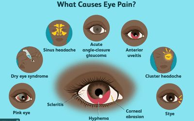 Corneal Abrasion, Eye Medicine, Computer Vision Syndrome, Daily Hygiene, Bloodshot Eyes, Eye Pain, Sore Neck, Eye Damage, Sinus Headache