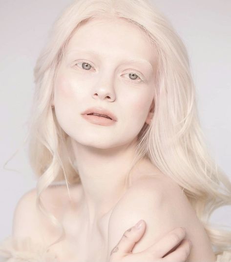 #albinogirl #albino #albinism #whitehair #white White Hair, Albino Human, Albino Girl, Pretty Brown Eyes, Angels Beauty, Arte Peculiar, Targaryen Aesthetic, Model Aesthetic, Favorite Hairstyles