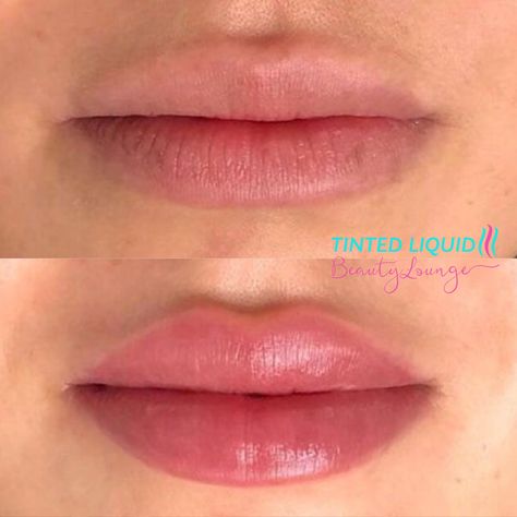 Lip Flip Inspiration, Lip Tattoo Makeup, Lips Blush Tattoo, Lip Blush Natural, Permanent Lip Makeup, Lip Fillers Natural Look, Lip Filler Vs Lip Flip, Heavy Lower Lip Filler, Natural Lip Tattoo