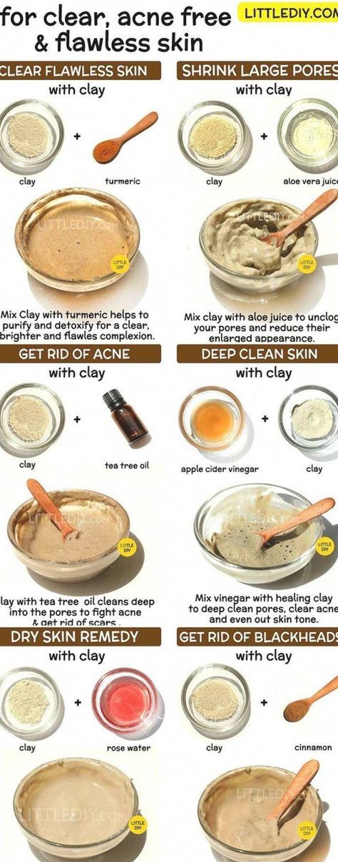 #NaturalWaysToPreventHairLoss Skin Care Routine Indian, Indian Healing Clay Mask, Clay Mask Recipe, Diy Clay Mask, Clay Hair Mask, Aztec Clay Mask, Deep Clean Skin, Aztec Clay, Bentonite Clay Mask