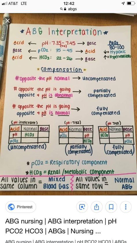 Nursing Desmopressin Nursing, Advanced Med Surg Nursing, Hypervolemia Nursing, Nursing Students Humor, Nursing School Notes Study Guides, Memes Nursing, Registered Nurse School, Nursing School Life, Nursing Pictures