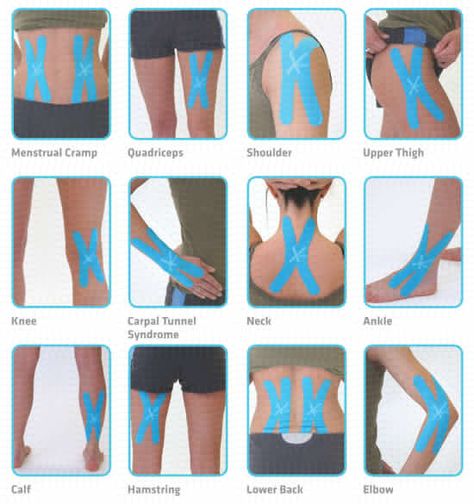 Athletic Training Sports Medicine, Bh Tricks, Kinesio Taping, Sports Tape, Elbow Pain, Kinesiology Taping, Nerve Pain Relief, Knee Pain Relief, Trening Abs