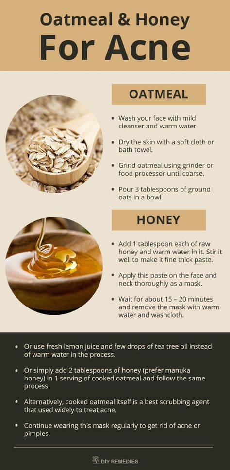 Mask – 1: (Oatmeal – Honey)  Honey has antibacterial, antioxidant and anti-i... Check more at http://www.yourfacebeauty.info/mask-1-oatmeal-honey-honey-has-antibacterial-antioxidant-and-anti-i/ Diy Face Mask Acne, Oat Face Mask, Diy Oatmeal Face Mask, Diy Face Mask For Acne, Oats Face Mask, Oily Skin Face Mask, Acne Face Mask Homemade, Diy Acne Mask, Face Mask Acne