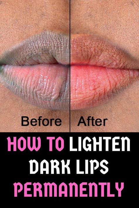 For Pink Lips, Lighten Dark Lips, Remedies For Dark Lips, Lip Lightening, Natural Pink Lips, Remedies For Glowing Skin, Home Remedies For Pimples, Dark Lip, Lip Scrub Homemade