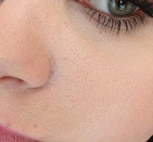 Bumpy, dry skin = Cakey Foundation HELP. | Beautylish Make Up Tips, Dry Skin Around Nose, Dry Forehead, Cakey Makeup, Bumpy Skin, Flaky Skin, Jewelry Shopping, Skin Makeup, Dry Skin
