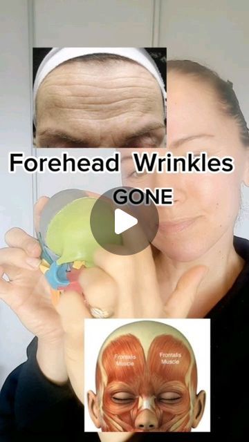 Forehead Gua Sha, Face Yoga For Lips, Gua Sha For Forehead Wrinkles, Face Yoga Forehead Wrinkles, Face Yoga Exercises For Wrinkles, Gua Sha Forehead Wrinkles, Forehead Wrinkles Remedies, Deep Forehead Wrinkles, Face Message