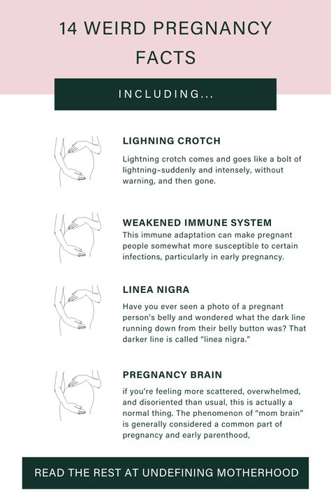 Pregnancy Facts Interesting, Facts About Pregnancy, Perineal Tear, Pregnancy Facts, Pregnancy Pain, Pregnancy Calculator, Pregnancy Checklist, Mom Brain, All About Mom