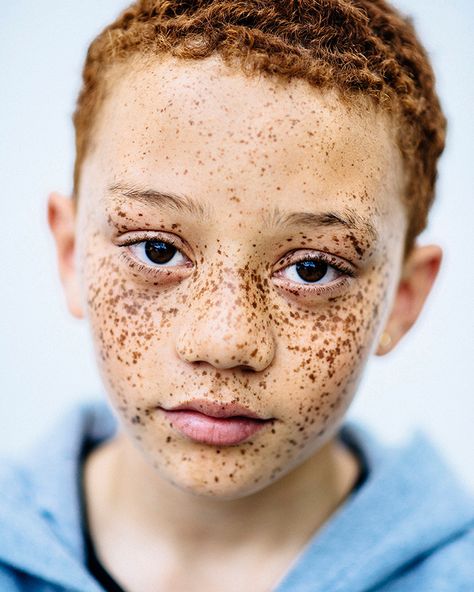 for-redheads — MC1R Project by Michelle Marshall  |  tumblr ... Drawing People, Ginger Person, People With Freckles, Beautiful Freckles, Freckle Face, Pictures Of People, Photo Series, Interesting Faces, Belleza Natural