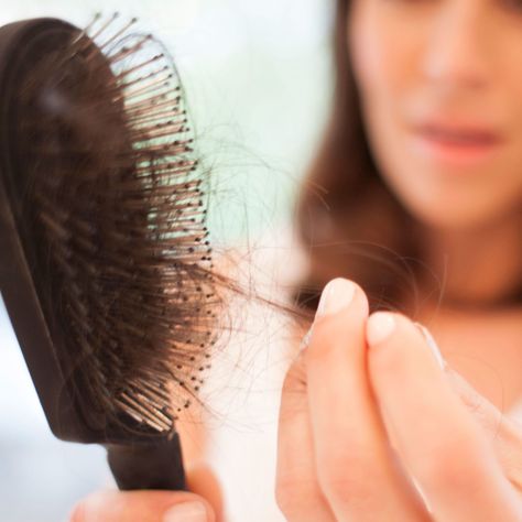 Hair loss may be irregular if you are losing even more than 100 hairs a day. This might cause a basic thinning of hair or in a patchy hair loss over the scalp. #hairlosshelp Regrow Hair Naturally, Androgenetic Alopecia, Pattern Hair, Make It Stop, Regrow Hair, New Hair Growth, Lost Hair, Hair Restoration, Hair Regrowth