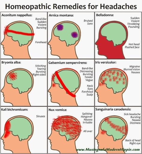 Natural homeopathic remedies for 9 types of headaches. A great alternative to modern medications - effective, natural. Sinus headache? Hangover? Migraine? How To Stop Migraines, Remedies For Headaches, Hangover Headache, Natural Headache, Throbbing Headache, For Headaches, Headache Types, Sinus Headache, Natural Headache Remedies