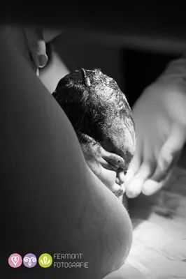 Birth Photographer Captures Exact Moment Babies' Heads Are Born In Fascinating And Rare Photos | HuffPost Life Delivery Room Pictures, Delivery Room Photography, Delivery Room Photos, Childbirth Photos, Child Birth Photography, Labor Photos, Born Baby Photos, Twin Baby Photos, Birth Delivery