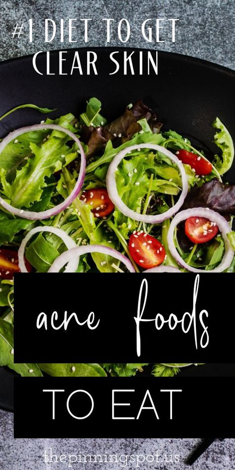 Here are clean eating delights to help you clear acne super fast. These clean eating delights/ acne foods get rids of lifestyle induced acne that comes from living an unhealthy lifestyle and eating unhealthily. If you want to finally clear your stubborn acne, begin by incorporating these clean eating delight into your acne diet and watch your acne breakouts become less server and less common