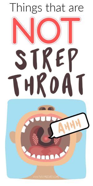Let's talk abut Strep Throat symptoms, how to tell if you have strep vs a sore throat.  If essential oils can be helpful?  Also, what to do if you have strep throat when pregnant.  How LONG is strep throat contagious, can you be a carrier?  Did you know that strep throat has different symptoms in children and that it can ONLY be teated by antibiotics?  Yup, lots to learn about strep throat from this RN -- so let's get going! Sore Throat Remedies For Adults, Strep Throat Symptoms, Strep Throat Remedies, Scratchy Throat, Sore Throat Remedies, Throat Remedies, Throat Pain, Throat Infection, Strep Throat