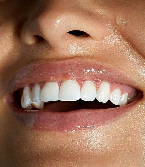 Beautiful Smile Teeth, Whiten Teeth Fast, Teeth Aesthetic, Peroxide Teeth Whitening, Pretty Teeth, Kesehatan Gigi, Beautiful Teeth, Teeth Whitening Gel, Perfect Teeth