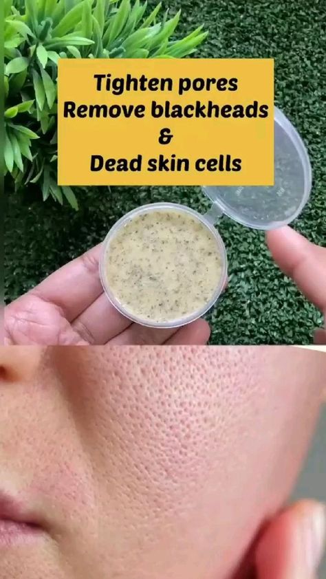 Haut Routine, Open Pores, Diy Skin Care Routine, Clear Healthy Skin, Natural Skin Care Remedies, Natural Face Skin Care, Skin Care Face Mask, Good Skin Tips, Diy Skin Care Recipes