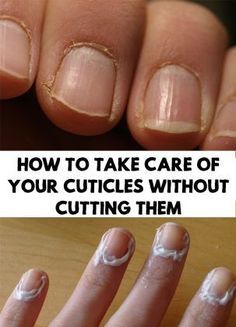 Pregnancy Health, Cuticle Care, Nail Care Tips, Nail Growth, How To Grow Nails, Nail Health, Hand Care, Healthy Nails, Manicure E Pedicure