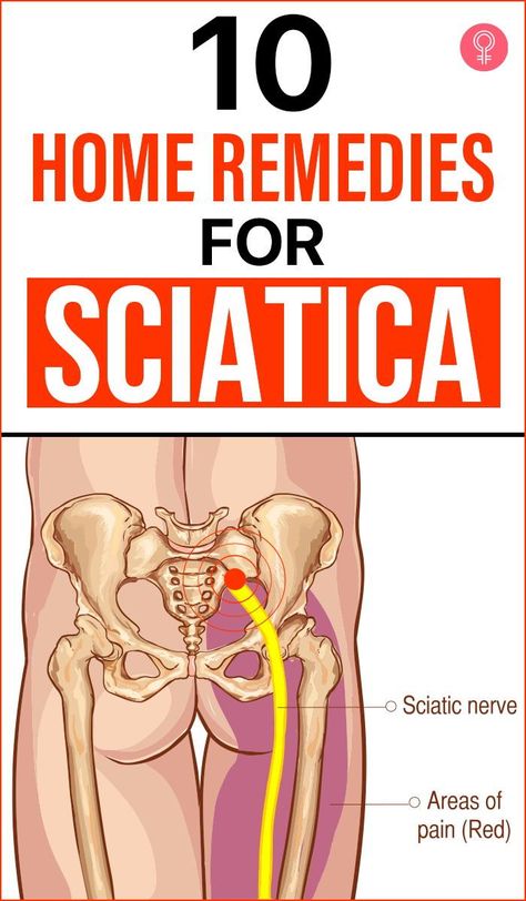 10 Home Remedies For Sciatica: Sciatica pain can be incapacitating and agonizing, throwing your life into disarray. To assist you in managing sciatica symptoms, we’ve put together a list of basic home treatments in this post. Continue reading to learn more. #remedies #sciatica #homeremedies Sciatica Symptoms, Sciatica Pain Relief, Back Stretches For Pain, Back Pain Remedies, Upper Back Pain, Hip Flexors, Nerve Pain Relief, Sciatic Nerve Pain, Knee Pain Relief
