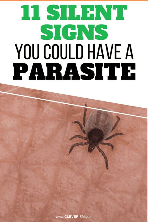 11 Silent Signs You Could Have a Parasite. Most people suffer unknowingly from parasites. Here's the definitive checklist. Find out whether you have parasites or not.  - #SilentSignsYouHaveAParasite #Parasites #Cleverism Parasites Symptoms, Types Of Strokes, Parasite Cleanse, Health Articles Wellness, Wellness Clinic, Job Interview Tips, Stomach Pain, Health Articles, What You Eat