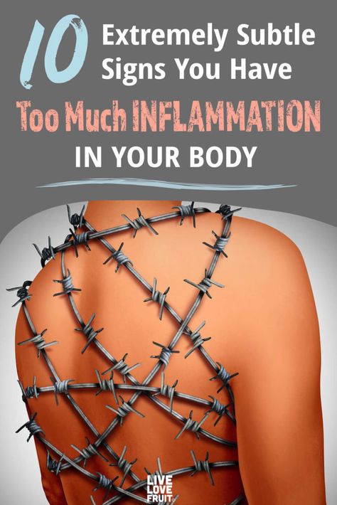 human body wrapped in barbed wire to demonstrate the pain of chronic inflammation with text - 10 extremely subtle signs your have too much inflammation in your body Anti Inflamatory Diet, Eat Natural, Inflammation Remedies, Anti Inflamatory, Body Inflammation, Anti Inflammation Recipes, Inflammation Diet, Wellness Planner, Anti Inflammation